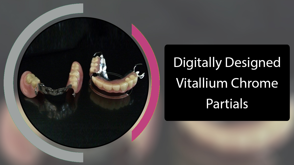 Full Dentures